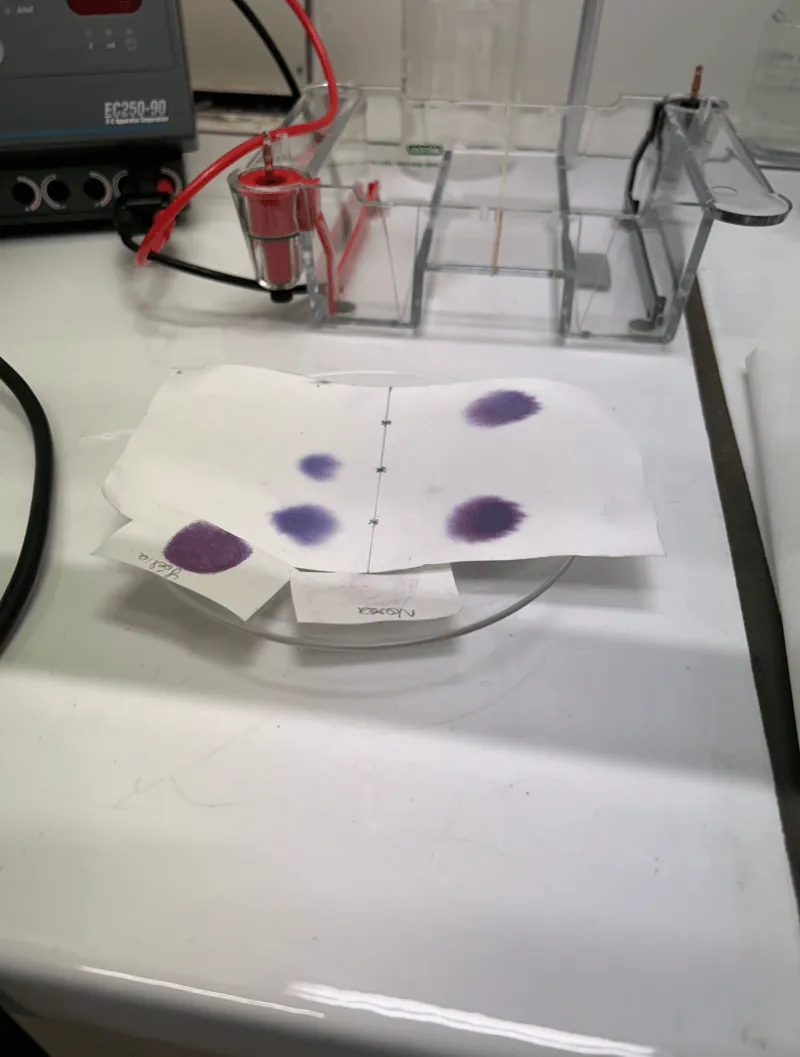 Acide amine electrophorese